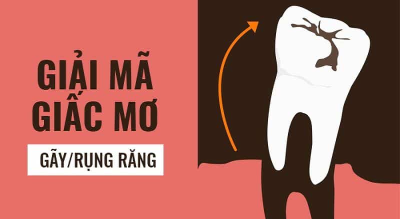 Mơ rụng răng